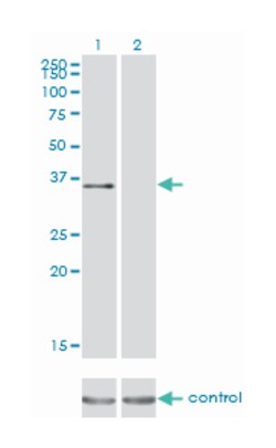 ATF1, Mouse, Clone: 3E7, Abnova 100 &mu;g | Buy Online | Abnova | Fisher Scientific