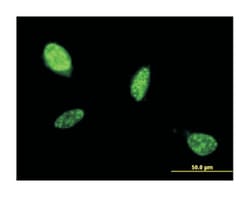 ATOH1, Mouse, Clone: 1B12, Abnova 100&mu;g; Unlabeled:Antibodies, Monoclonal