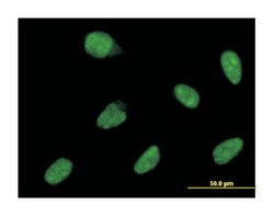 ATOH1, Mouse, Clone: 3E2, Abnova 100&mu;g; Unlabeled:Antibodies, Monoclonal