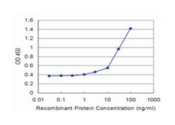 ATP1B2, Mouse, Clone: 4E3, Abnova 100 &mu;g | Buy Online | Abnova Corporation | Fisher Scientific