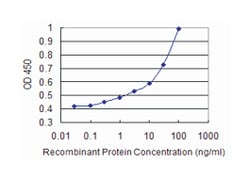 ATP2A3, Mouse, Clone: 1B9, Abnova 100 &mu;g | Buy Online | Abnova Corporation | Fisher Scientific