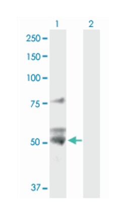 ATP5B, Rabbit, Purified MaxPab Polyclonal Antibody, Abnova 100 &mu;g | Buy Online | Abnova | Fisher Scientific