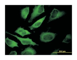 ATP6V1A, Mouse, Clone: 4F5, Abnova&trade;