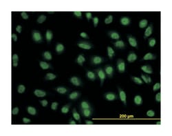 B-cell CLL/lymphoma 9, Mouse, Clone: 2D4, Abnova 100&mu;g; Unlabeled:Antibodies,