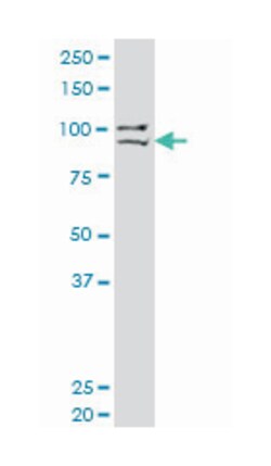 PR domain containing 1, with ZNF domain, Mouse, Clone: 2F8, Abnova 100&mu;g;