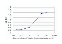 BMP5, Mouse, Clone: 4D10, Abnova 100 &mu;g | Buy Online | Abnova | Fisher Scientific