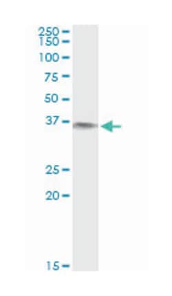 BLVRA, Mouse, Clone: S2, Abnova 100 &mu;g | Buy Online | Abnova | Fisher Scientific