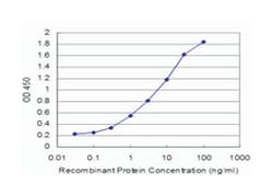 BMP5, Mouse, Clone: 4B3, Abnova 100 &mu;g | Buy Online | Abnova | Fisher Scientific