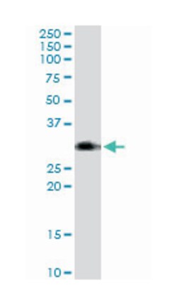 bone marrow stromal cell antigen 2, Mouse, Purified MaxPab Polyclonal Antibody,