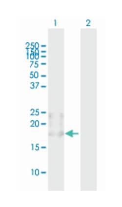 bone marrow stromal cell antigen 2, Mouse, Purified MaxPab Polyclonal Antibody,