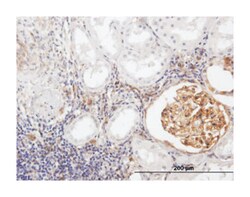 bone marrow stromal cell antigen 2, Mouse, Purified MaxPab Polyclonal Antibody,