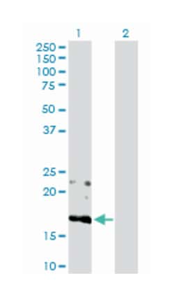 bone marrow stromal cell antigen 2, Rabbit, Polyclonal Antibody, Abnova 100 &mu;g | Buy Online | Abnova | Fisher Scientific