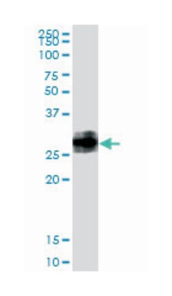 bone marrow stromal cell antigen 2, Rabbit, Polyclonal Antibody, Abnova 100 &mu;g | Buy Online | Abnova | Fisher Scientific