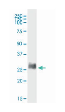bone marrow stromal cell antigen 2, Rabbit, Polyclonal Antibody, Abnova 100 &mu;g | Buy Online | Abnova | Fisher Scientific