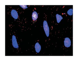 betacellulin, Rabbit, Purified MaxPab Polyclonal Antibody, Abnova 100 &mu;g | Buy Online | Abnova Corporation | Fisher Scientific