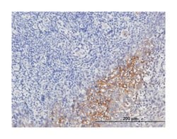 serpin peptidase inhibitor, clade G (C1 inhibitor), member 1, Mouse, Purified