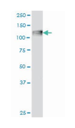 C3, Mouse, Clone: 5F9, Abnova 200&mu;L; Unlabeled:Anticuerpos
