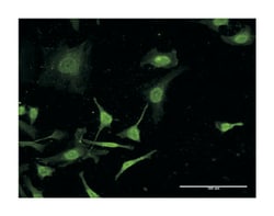C4B, Mouse, Clone: 1F2, Abnova 100&mu;g; Unlabeled:Antibodies, Monoclonal