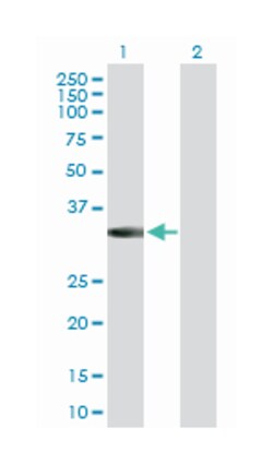 metallophosphoesterase domain containing 2, Rabbit, Purified MaxPab Polyclonal Antibody, Abnova 100 &mu;g | Buy Online | Abnova Corporation | Fisher Scientific