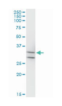 MPPED2, Mouse, Clone: 4H5, Abnova 100 &mu;g | Buy Online | Abnova Corporation | Fisher Scientific