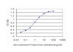 CA1, Mouse, Clone: 7G12, Abnova 100&mu;g; Unlabeled:Antibodies, Monoclonal