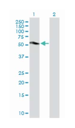 carbonic anhydrase IX, Rabbit, Purified MaxPab Polyclonal Antibody, Abnova