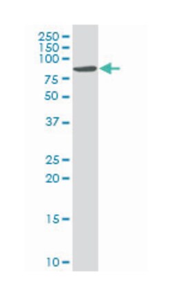calcium channel, voltage-dependent, beta 2 subunit, Mouse, Polyclonal Antibody, Abnova&trade;