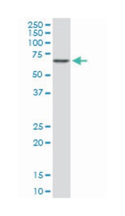 calcium channel, voltage-dependent, beta 2 subunit, Mouse, Clone: 6C4,