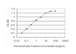 calcium channel, voltage-dependent, beta 2 subunit, Mouse, Clone: 6C4,