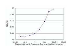 CALCR, Mouse, Clone: 2F7, Abnova 100&mu;g; Unlabeled:Antibodies, Monoclonal