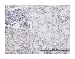CALML3, Mouse, Clone: 2A11, Abnova 100&mu;g; Unlabeled:Antibodies, Monoclonal