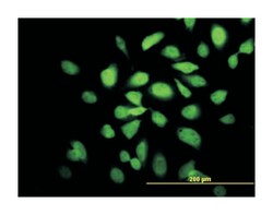 CAMK2A, Mouse, Clone: 2C4, Abnova 100&mu;g; Unlabeled:Antibodies, Monoclonal