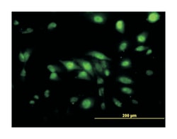 CAPG (M01), Mouse anti-Human, Clone: 1F1, Abnova 100&mu;g; Unlabeled:Antibodies,