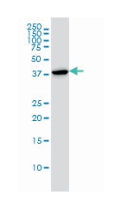 CAPG (M01A), Mouse anti-Human, Clone: 1F1, Abnova&trade;