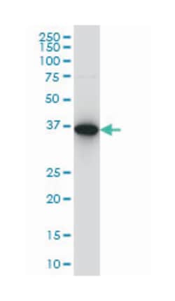 capping protein (actin filament), gelsolin-like, Mouse, Clone: 6D6, Abnova
