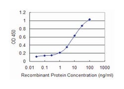 CAPN3, Mouse, Clone: 1B2, Abnova 100&mu;g; Unlabeled:Anticuerpos
