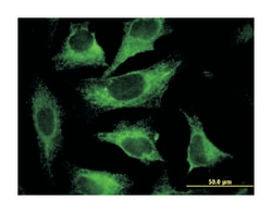 CAST, Mouse, Clone: 2C5, Abnova 100&mu;g; Unlabeled:Anticorps, Monoclonal