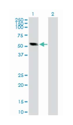 calsequestrin 2 (cardiac muscle), Rabbit, Purified MaxPab Polyclonal Antibody, Abnova 100 &mu;g | Buy Online | Abnova | Fisher Scientific