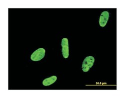 RUNX2, Mouse, Clone: 1D2, Abnova 100 &mu;g | Buy Online | Abnova | Fisher Scientific