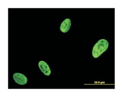 RUNX2, Mouse, Clone: 4C8, Abnova 100&mu;g; Unlabeled:Antibodies, Monoclonal