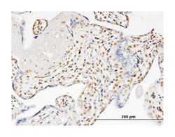 RUNX2, Mouse, Clone: 6E1, Abnova 100&mu;g; Unlabeled:Antibodies, Monoclonal