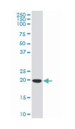 core-binding factor, beta subunit, Mouse, Polyclonal Antibody, Abnova&trade;