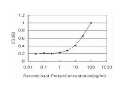 CBR1, Mouse, Clone: 4G11-1C7, Abnova&trade;