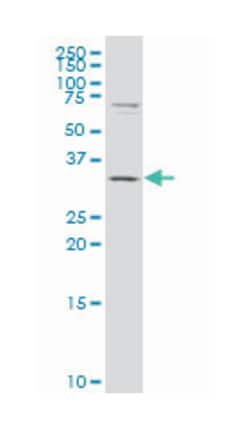 carbonyl reductase 3 (A01), Mouse anti-Human, Polyclonal Antibody, Abnova 50 &mu;L | Buy Online | Abnova Corporation | Fisher Scientific