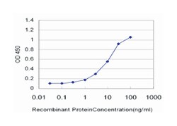 regulator of calcineurin 1, Mouse, Clone: 1B1, Abnova 100&mu;g; Unlabeled:Anticuerpos