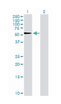 serpin peptidase inhibitor, clade F (alpha-2 antiplasmin, pigment epithelium