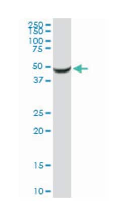 serpin peptidase inhibitor, clade A (alpha-1 antiproteinase, antitrypsin),