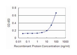SERPINI1, Mouse, Clone: 1E10, Abnova 100&mu;g; Unlabeled:Anticuerpos