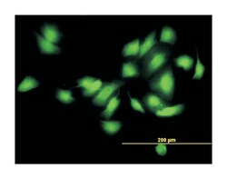 calcium/calmodulin-dependent protein kinase II alpha, Mouse, Clone: 2C12,