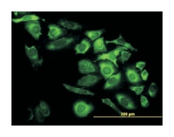 capping protein (actin filament), gelsolin-like, Mouse, Clone: 6D6, Abnova